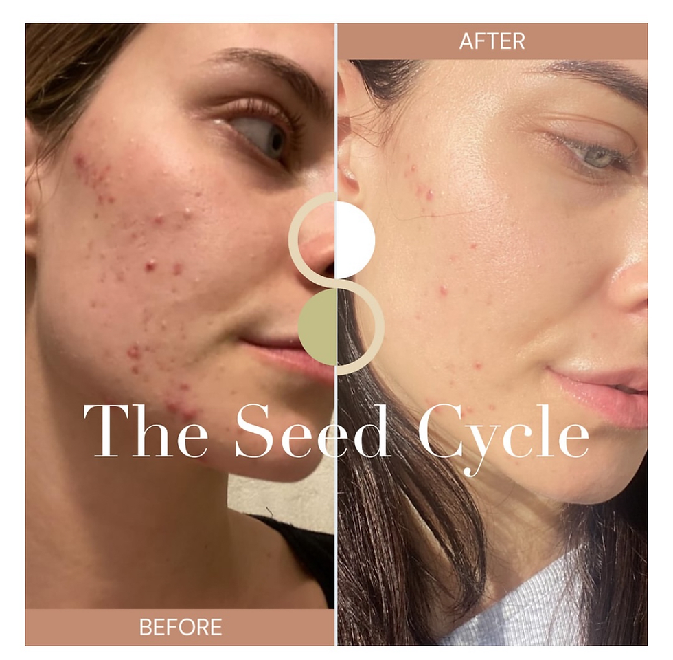 Thumbnail: The seed cycle 