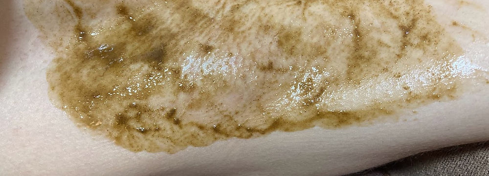 吉祥寺 ワキハーブピーリング ボディハーブピーリング Ruaina