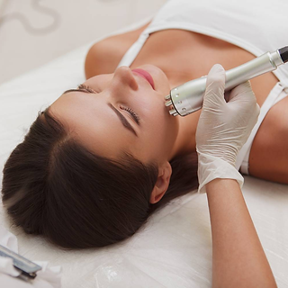 Tratamento de radiofrequência sendo realizado em uma área facial, com um dispositivo aplicando ondas de radiofrequência para 