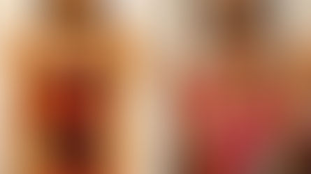 Skin Disease: Need No Scar Life Now