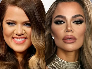 The Rise of the Unrecognisable Celebrity