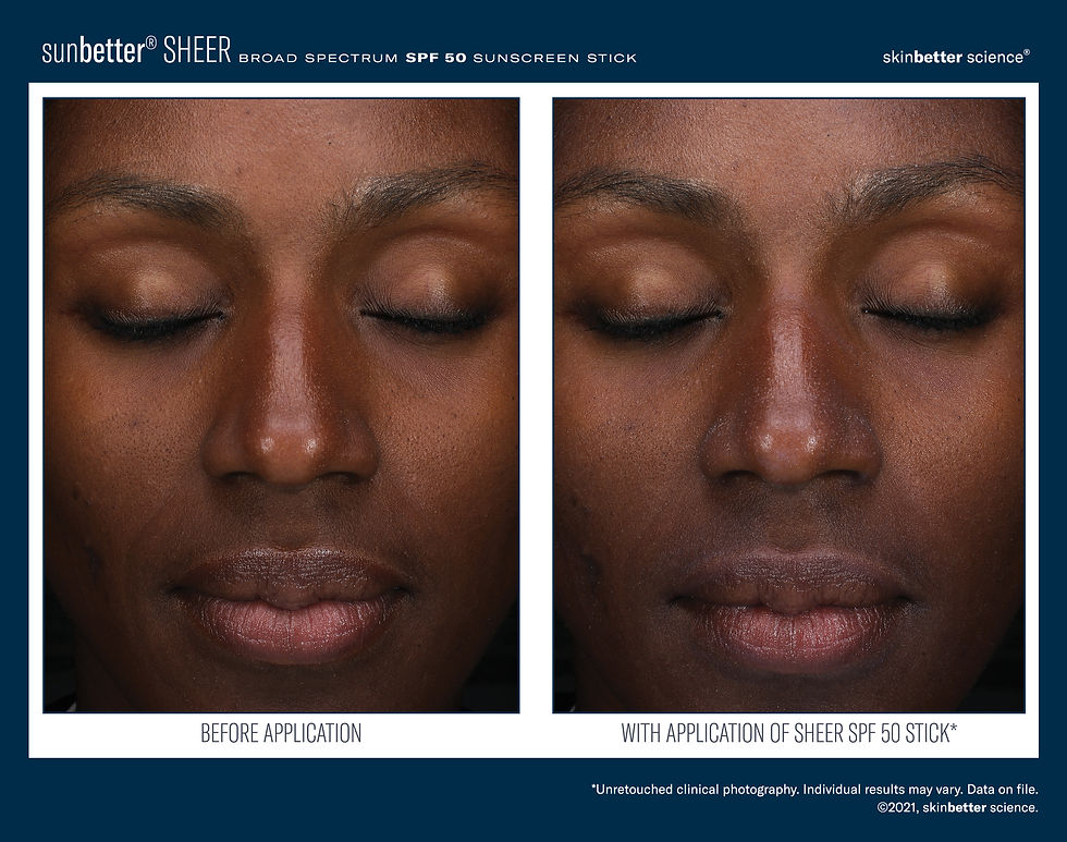 Thumbnail: SunBeter Sheer SPF 50
