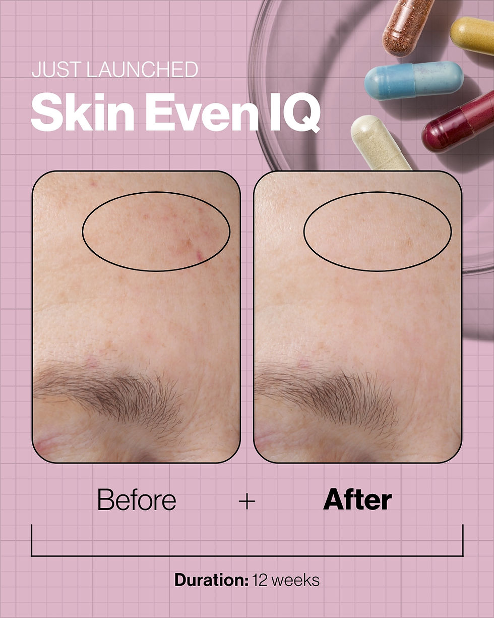 Thumbnail: Skin Even IQ