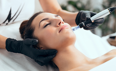 microneedling