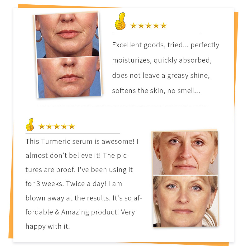 Thumbnail: Anti-Aging Moisturizer for Fine Lines