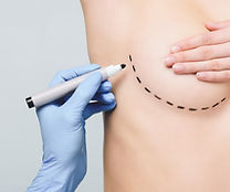 Cosmetic Surgery Grants - Breast Augmentation