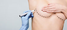 Cosmetic Surgery Grants - Breast Augmentation