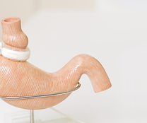CSG Bariatric.png