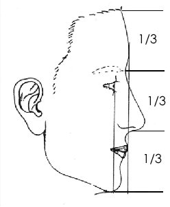 La face se divise en trois étages égaux. Le respect des proportions de la face et de la bouche garantie un aspect serein, reposé et rajeuni du visage - Orthosmile Abidjan