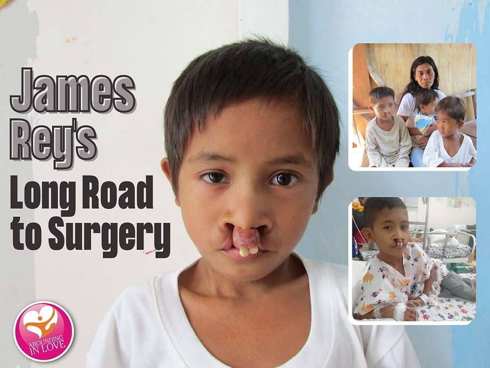 James Rey Christy James Rey’s Road to Surgery | Abounding in Love