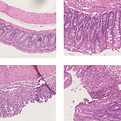 bowel H&E_edited.jpg