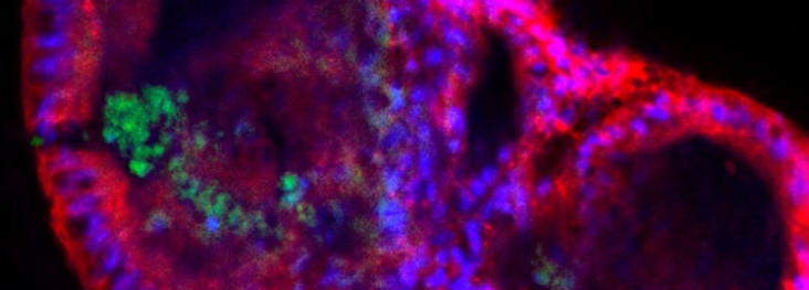 organoids 2.jpg