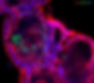 Human derived gut organoid