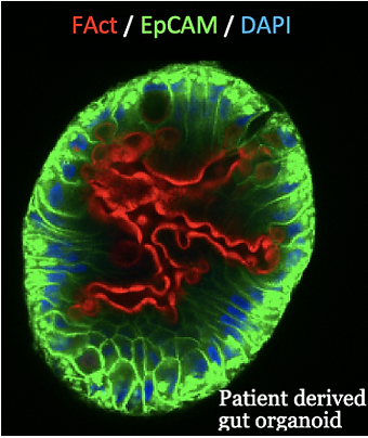 organoid1_edited.png