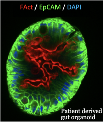organoid1_edited.png
