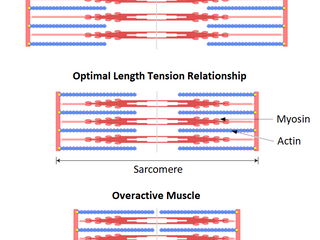 Overactive / Underactive Muscles. Everything you need to know.