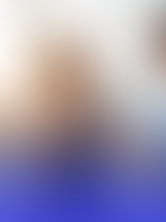 Fisioterapia Pós-Cirúrgica: É essencial para recuperar funções, reduzir dores e acelerar a reabilitação com segurança e eficiência