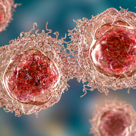 Minimal Residual Disease (MRD): Detecting Relapse Before It Becomes Clinically Apparent