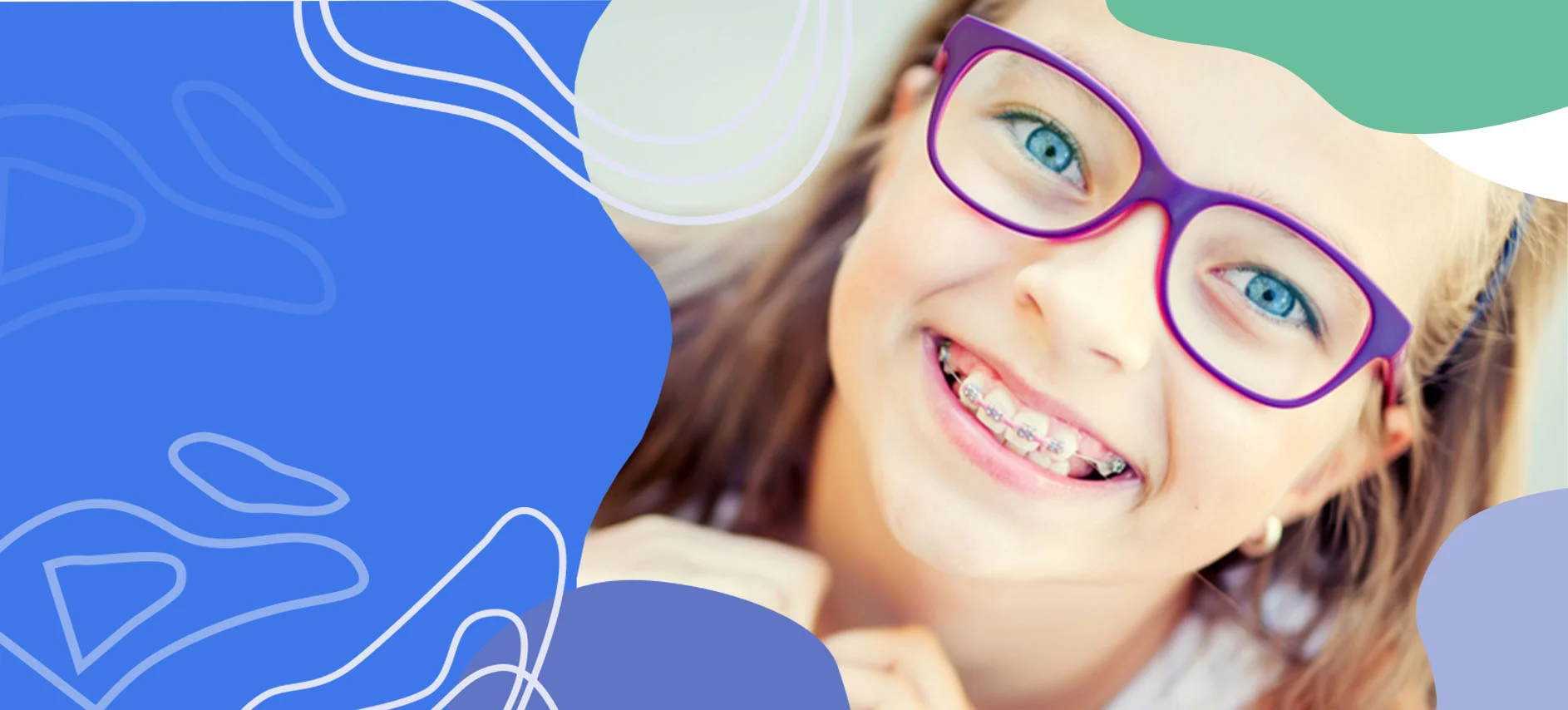 braces-kids.webp
