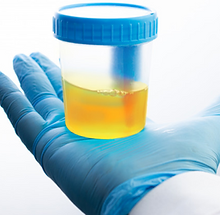 UROANALISIS