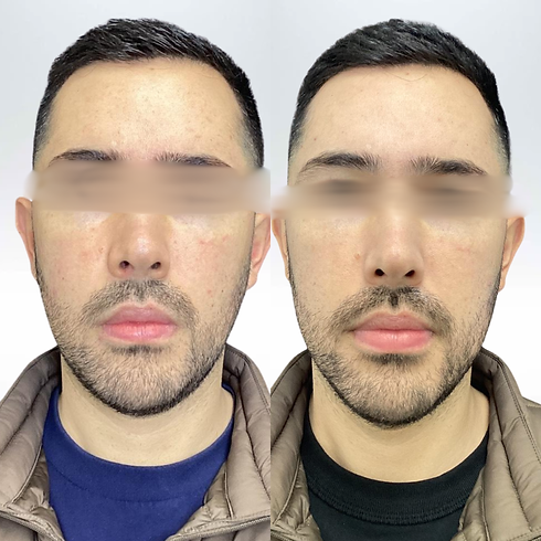 B&A 4.png