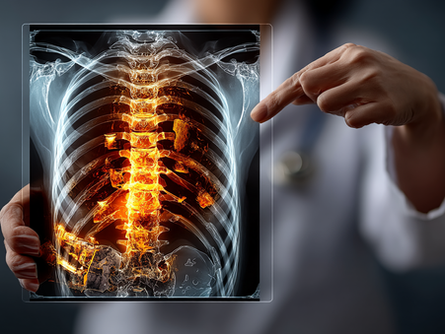 Avoiding Back Surgery in Buffalo, NY: Why Chiropractic Should Come First