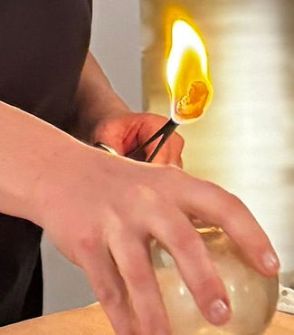 cupping picture_edited.jpg