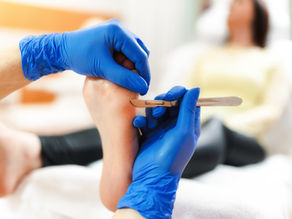 Podologia especializada na Mooca