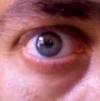 roneye_400x400.jpg