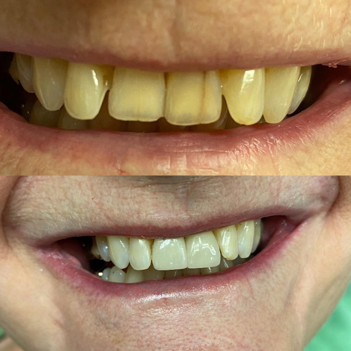 Slater Family Dentistry