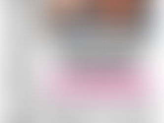 SECRET SHAME: I spent THOUSANDS trying to hide my balding… until a hair transplant changed my life