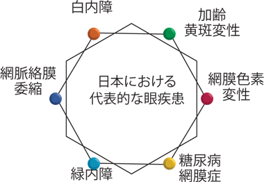 浦和区北浦和,メガネ,加齢黄斑変性,病気