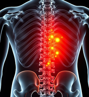 X-ray highlighting spine with red spots demonstrating pain. Atlanta Injury Care.