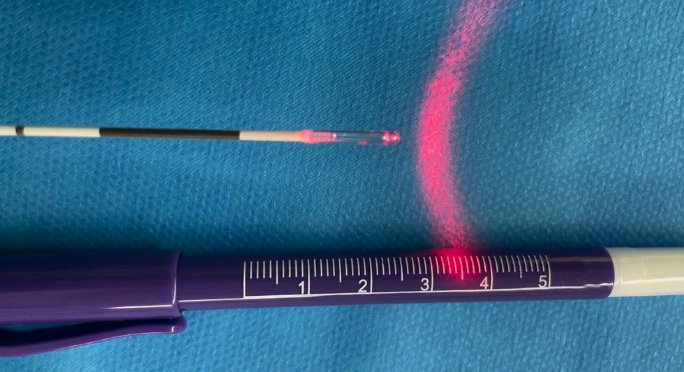 微創雷射靜脈曲張治療