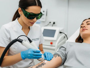 Laser Tattoo Removal Effectiveness: What You Need to Know