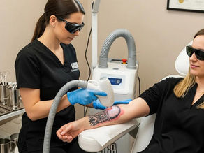 Is Laser Tattoo Removal Really Effective?