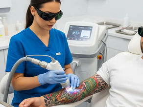 Understanding the Laser Tattoo Removal Process