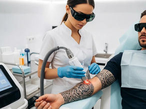 Arizona Laser Tattoo Removal Practice Laws Explained