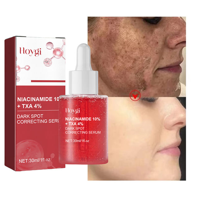 Thumbnail: Niacinamide Serum Dark Spot Correcting Moisturizing Brightening Fade Fine Lines 