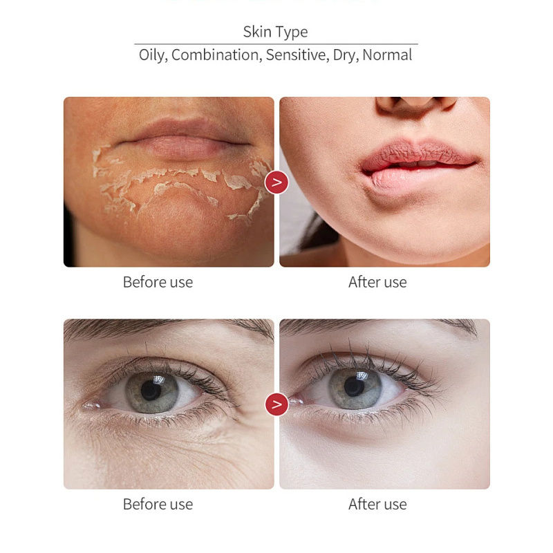 Thumbnail: Dragon Blood Wrinkle Remover Face Set Instant Firming Lifting Anti-Aging Serum F