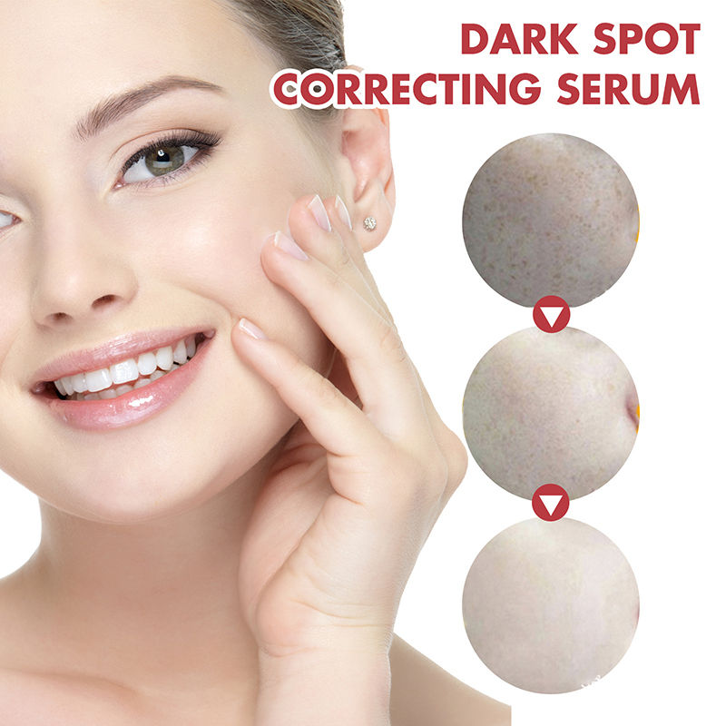 Thumbnail: Niacinamide Serum Dark Spot Correcting Moisturizing Brightening Fade Fine Lines 