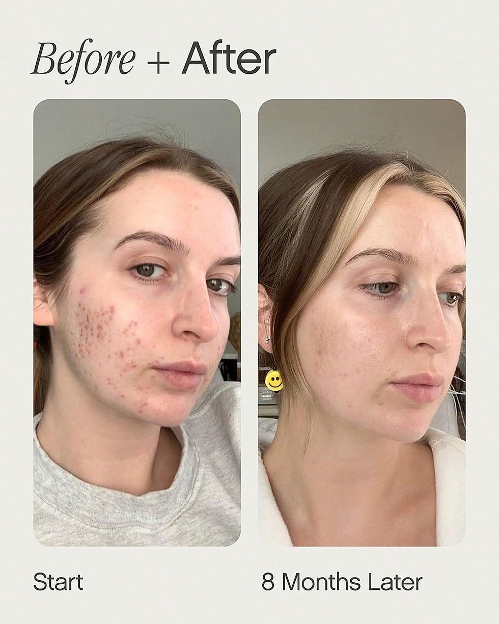 Thumbnail: Fade, whiten and clear essence | reduce spots and spots