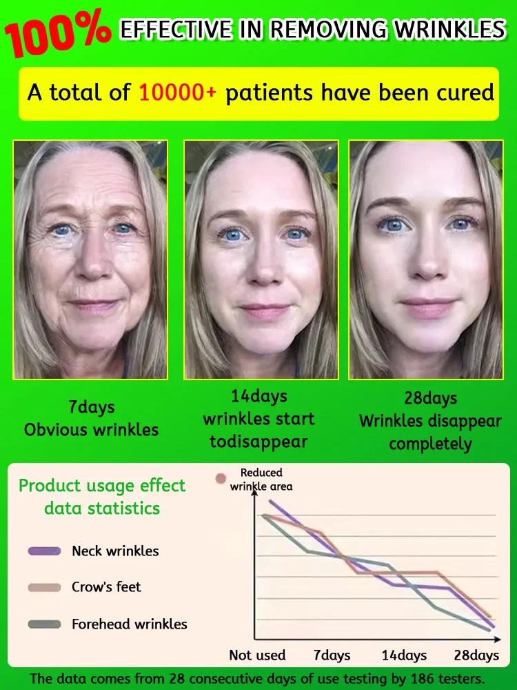 Thumbnail: Your wrinkles disappear