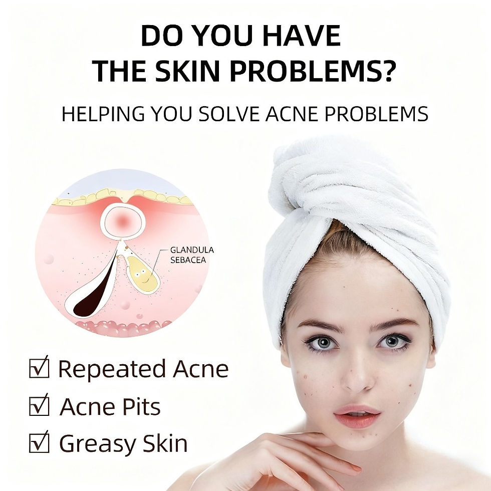 Thumbnail: 20g salicylic acid cream to lighten acne marks and shrink pores plant essence ge