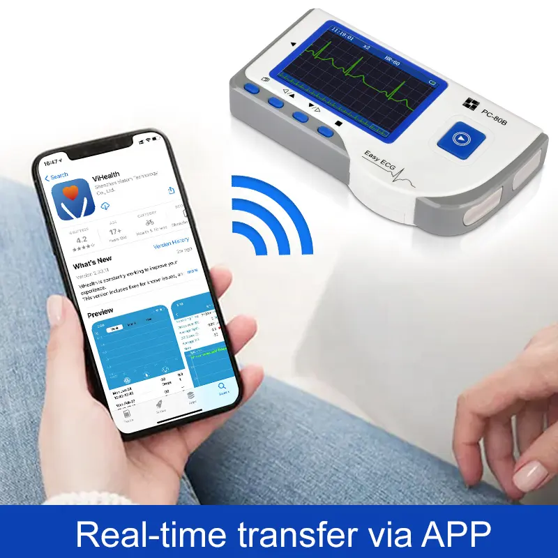 الصورة المصغرة: Viatom PC-80B Portable ECG Monitor Handheld LCD Heart Rate Tracker Single Leads 