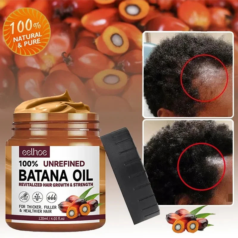 Thumbnail: Batana Hair Growth Oil Conditioner Anti Hair Loss Products Fast Growing Hair Mas