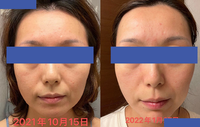 33歳女性