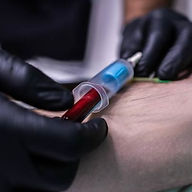 PRP Worthing P-Shot blood draw mrprp