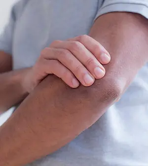 Tennis Elbow Treatment