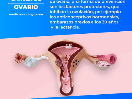 "Cáncer De Ovario"/ Dr. Franco Krakaur/ Cirujano Oncólogo